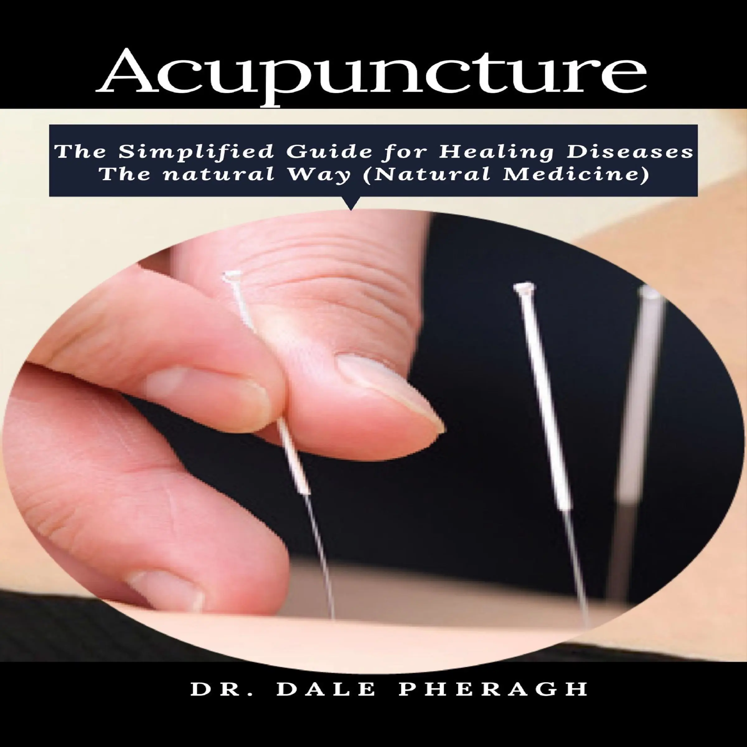 Acupuncture: The Simplified Guide for Healing Diseases The natural Way (Natural Medicine) Audiobook by Dr. Dale Pheragh