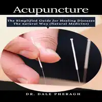 Acupuncture: The Simplified Guide for Healing Diseases The natural Way (Natural Medicine) Audiobook by Dr. Dale Pheragh