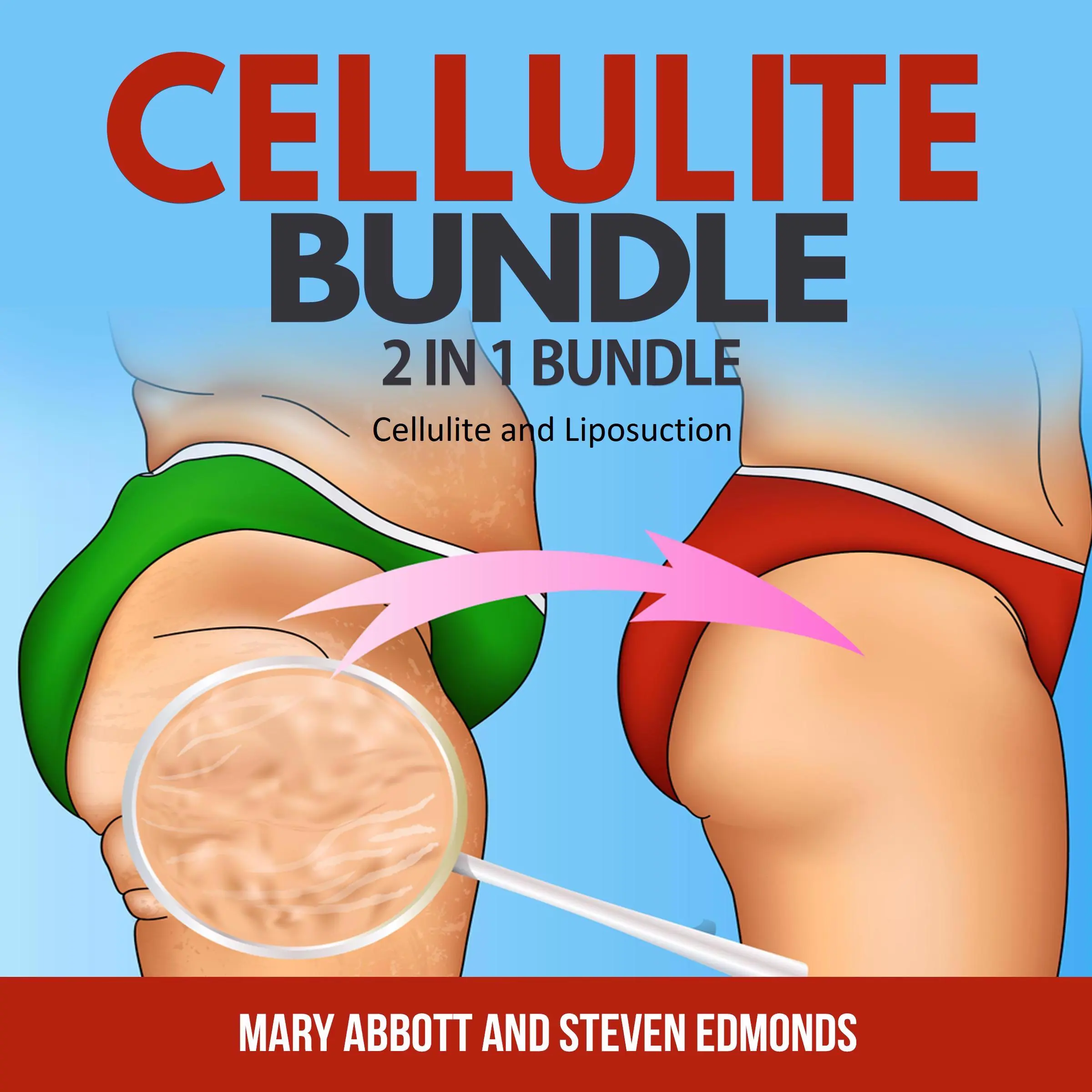 Cellulite Bundle: 2 in 1 Bundle, Cellulite, Liposuction Audiobook by Mary Abbott and Steven Edmonds
