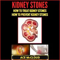 Kidney Stones: How To Treat Kidney Stones: How To Prevent Kidney Stones Audiobook by Ace McCloud