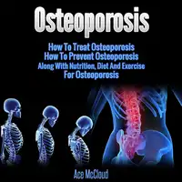 Osteoporosis: How To Treat Osteoporosis: How To Prevent Osteoporosis: Along With Nutrition, Diet And Exercise For Osteoporosis Audiobook by Ace McCloud