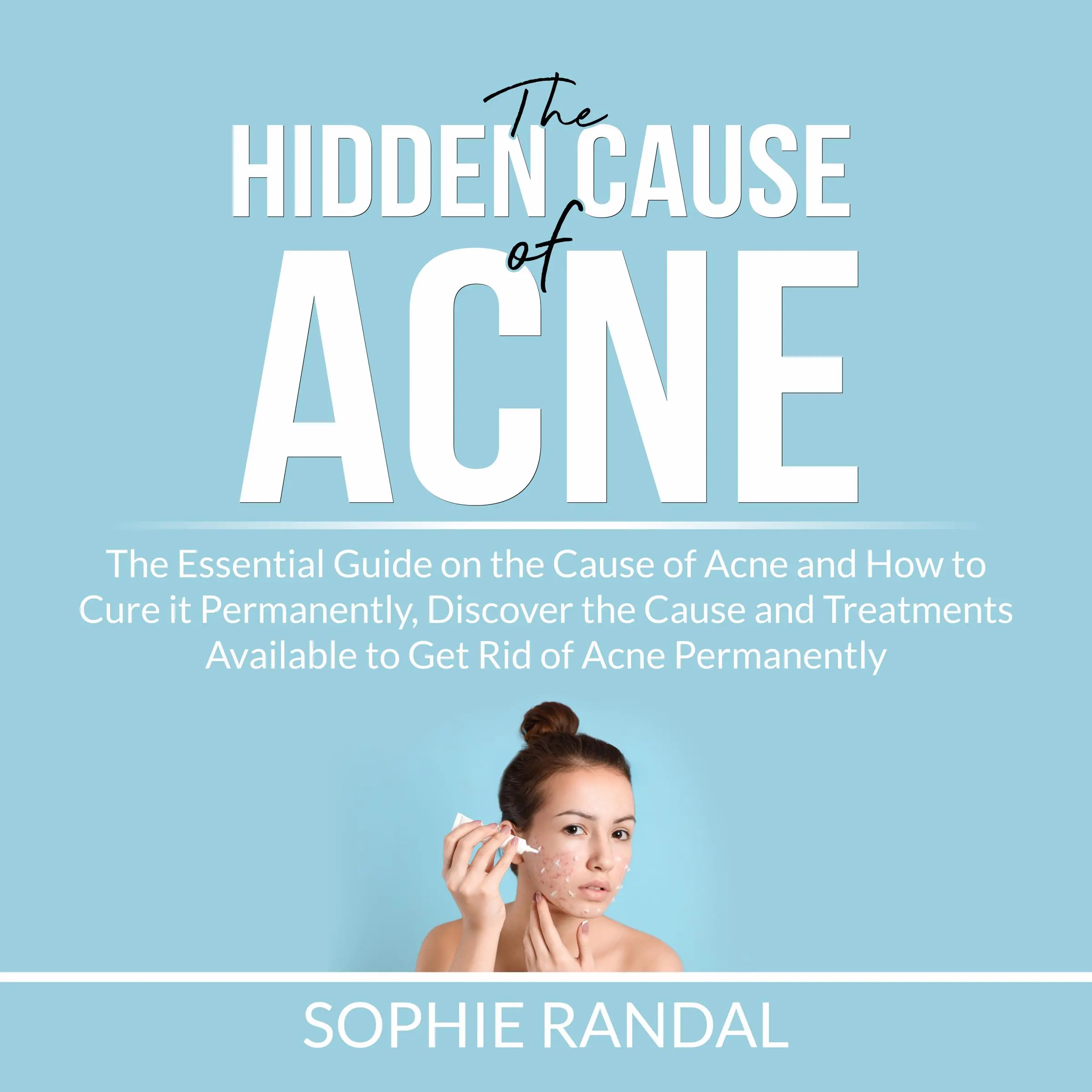 The Hidden Cause of Acne: the Essential Guide on the Cause of Acne and How to Cure it Permanently, Discover the Cause and Treatments Available to Get Rid of Acne Permanently Audiobook by Sophie Randal