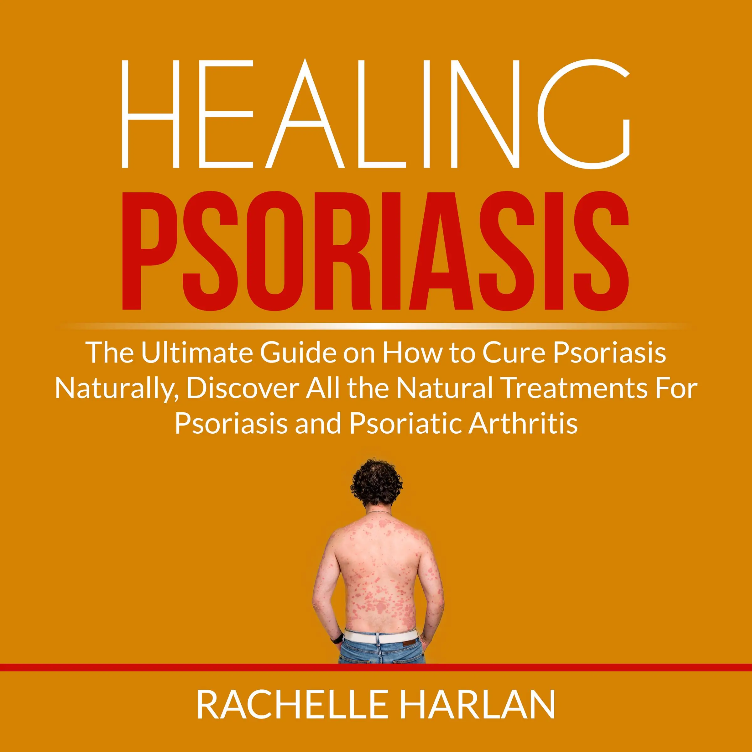 Healing Psoriasis: The Ultimate Guide on How to Cure Psoriasis Naturally, Discover All the Natural Treatments For Psoriasis and Psoriatic Arthritis by Rachelle Harlan Audiobook