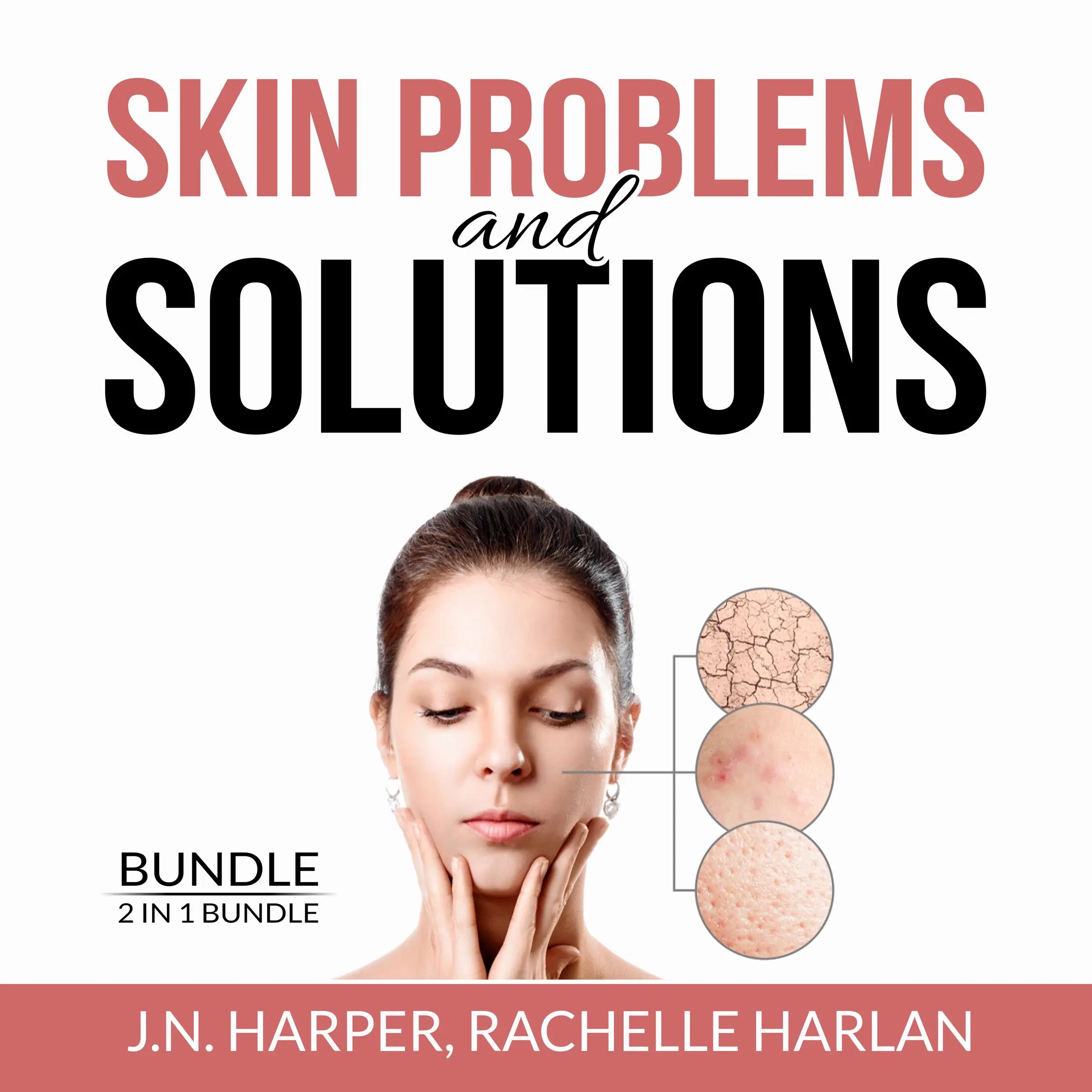 Skin Problems and Solutions Bundle: 2 in 1 Bundle, Eczema Detox and Healing Psoriasis Audiobook by and Rachelle Harlan