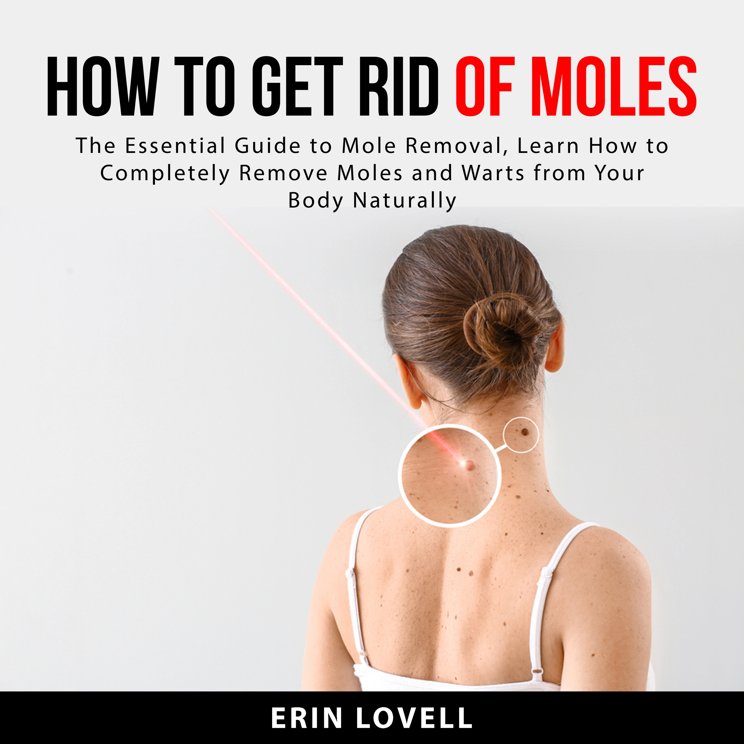 How to Get Rid of Moles by Erin Lovell Audiobook