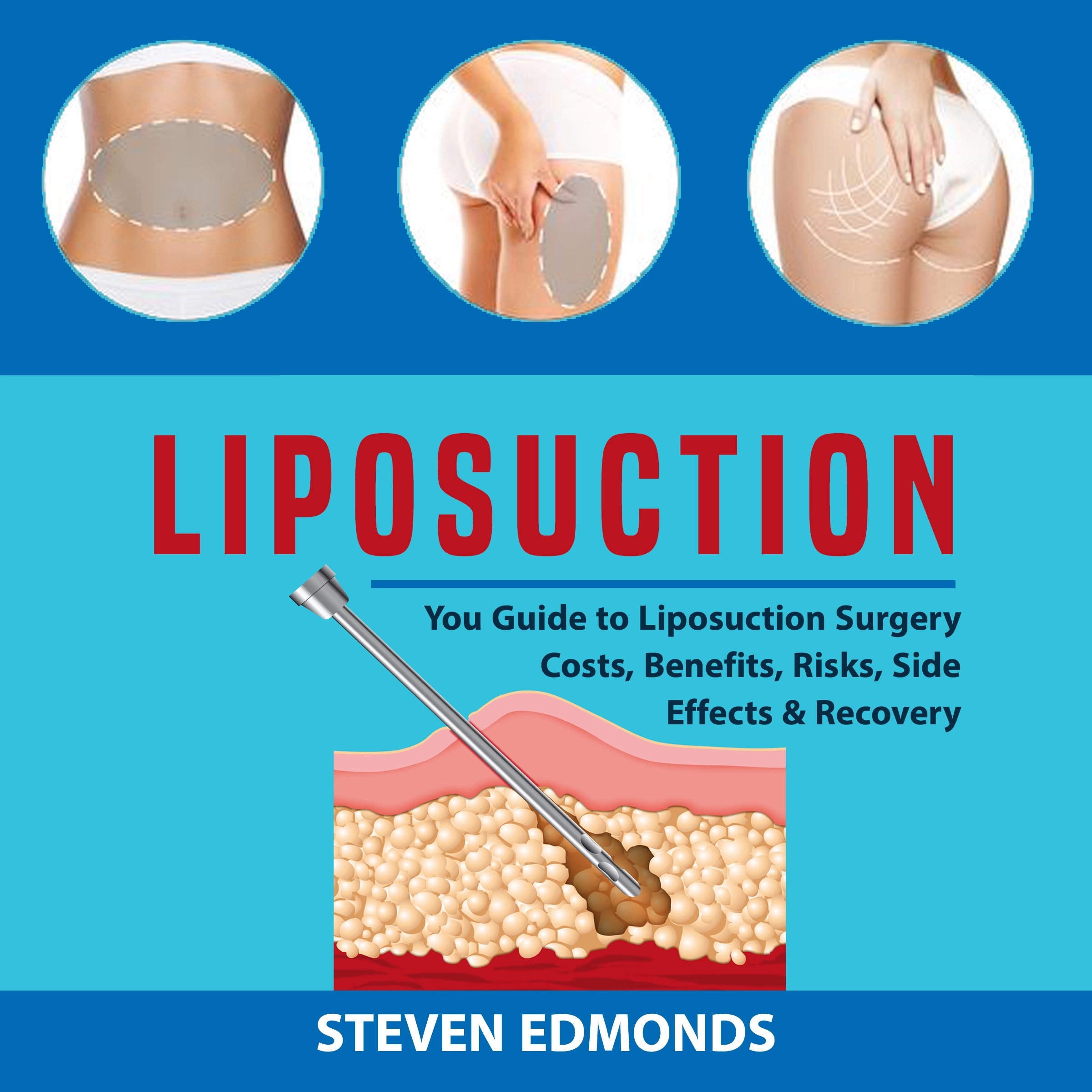 Liposuction: You Guide to Liposuction Surgery Costs, Benefits, Risks, Side Effects & Recovery Audiobook by Steven Edmonds