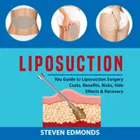 Liposuction: You Guide to Liposuction Surgery Costs, Benefits, Risks, Side Effects & Recovery Audiobook by Steven Edmonds