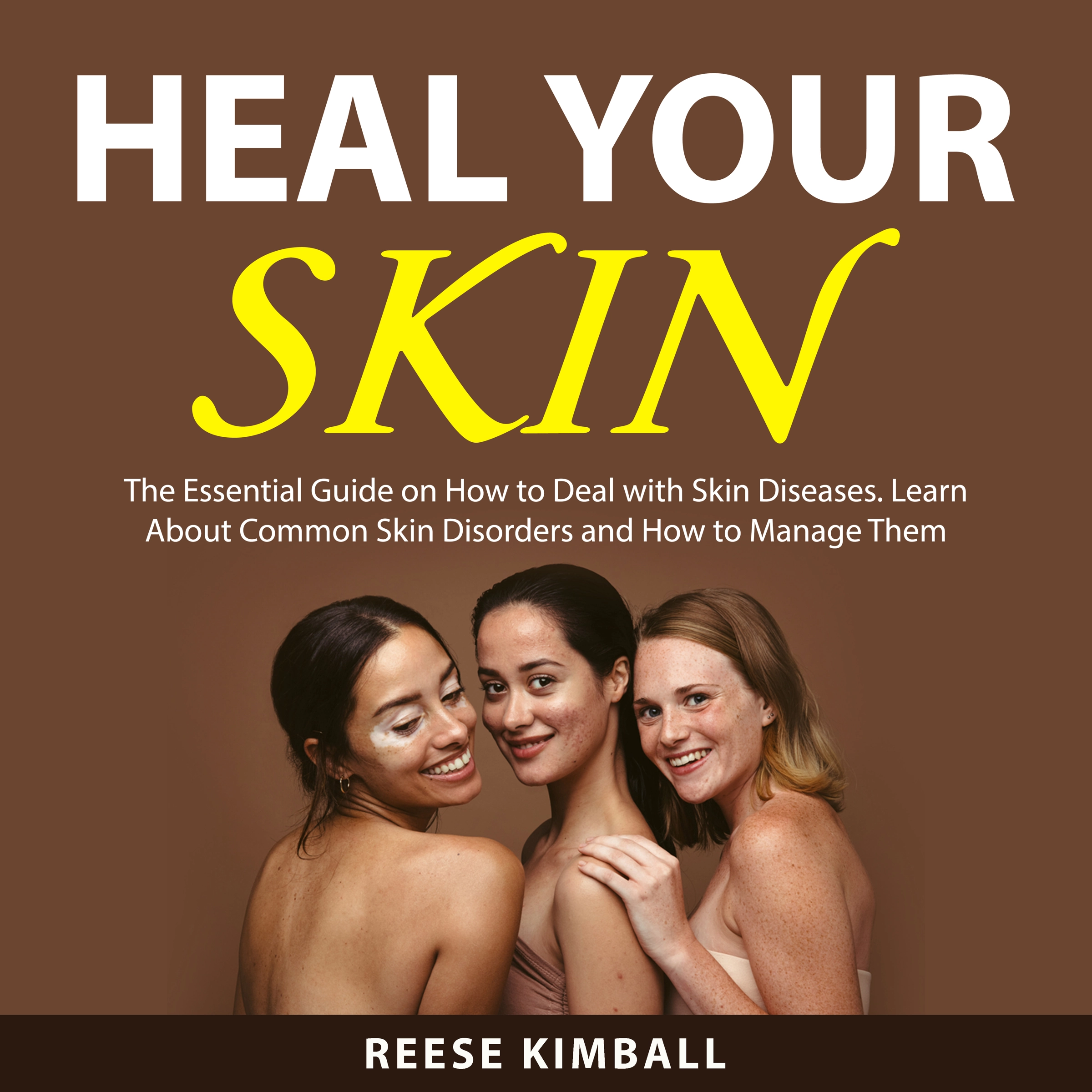 Heal Your Skin Audiobook by Reese Kimball