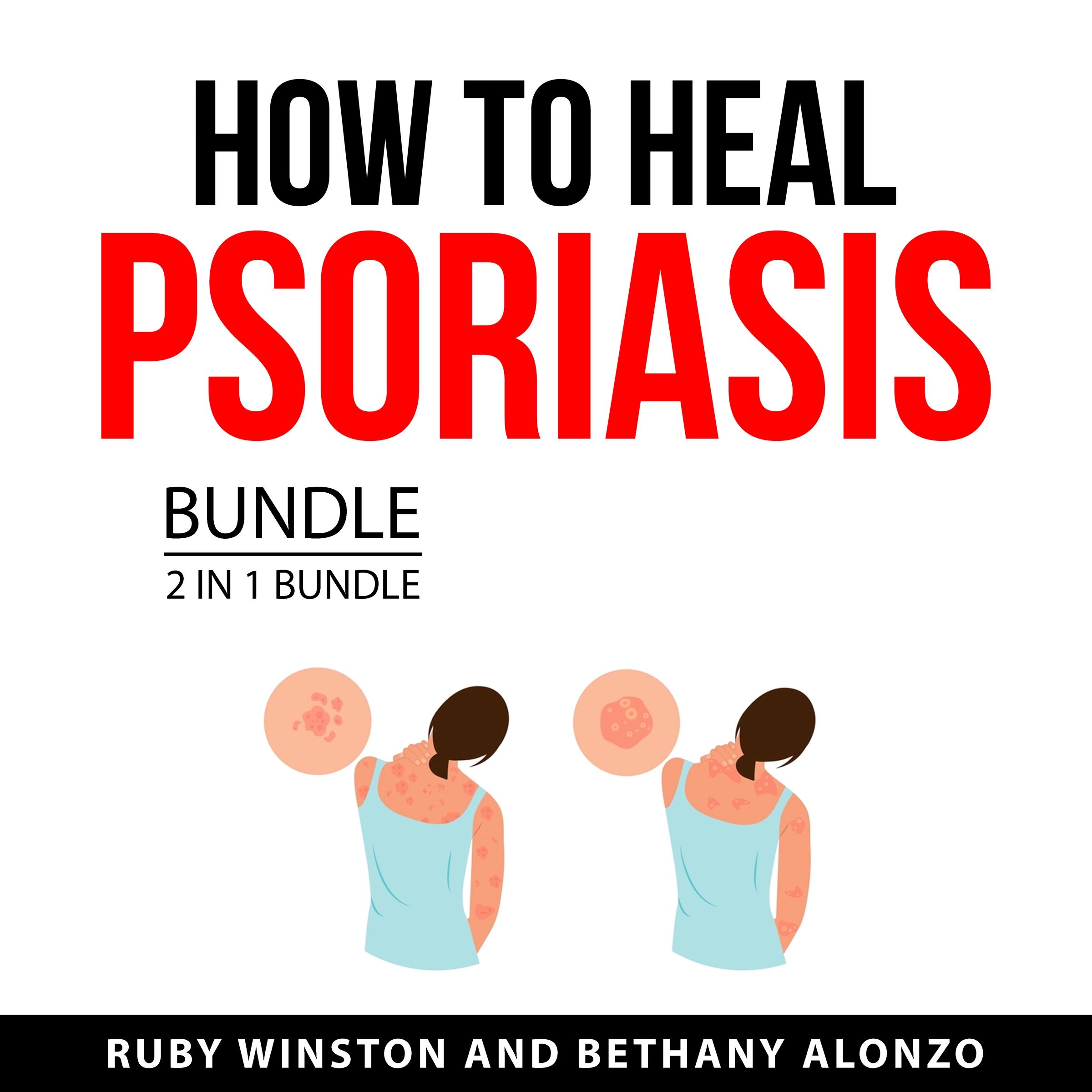 How to Heal Psoriasis Bundle, 2 in 1 Bundle by Bethany Alonzo