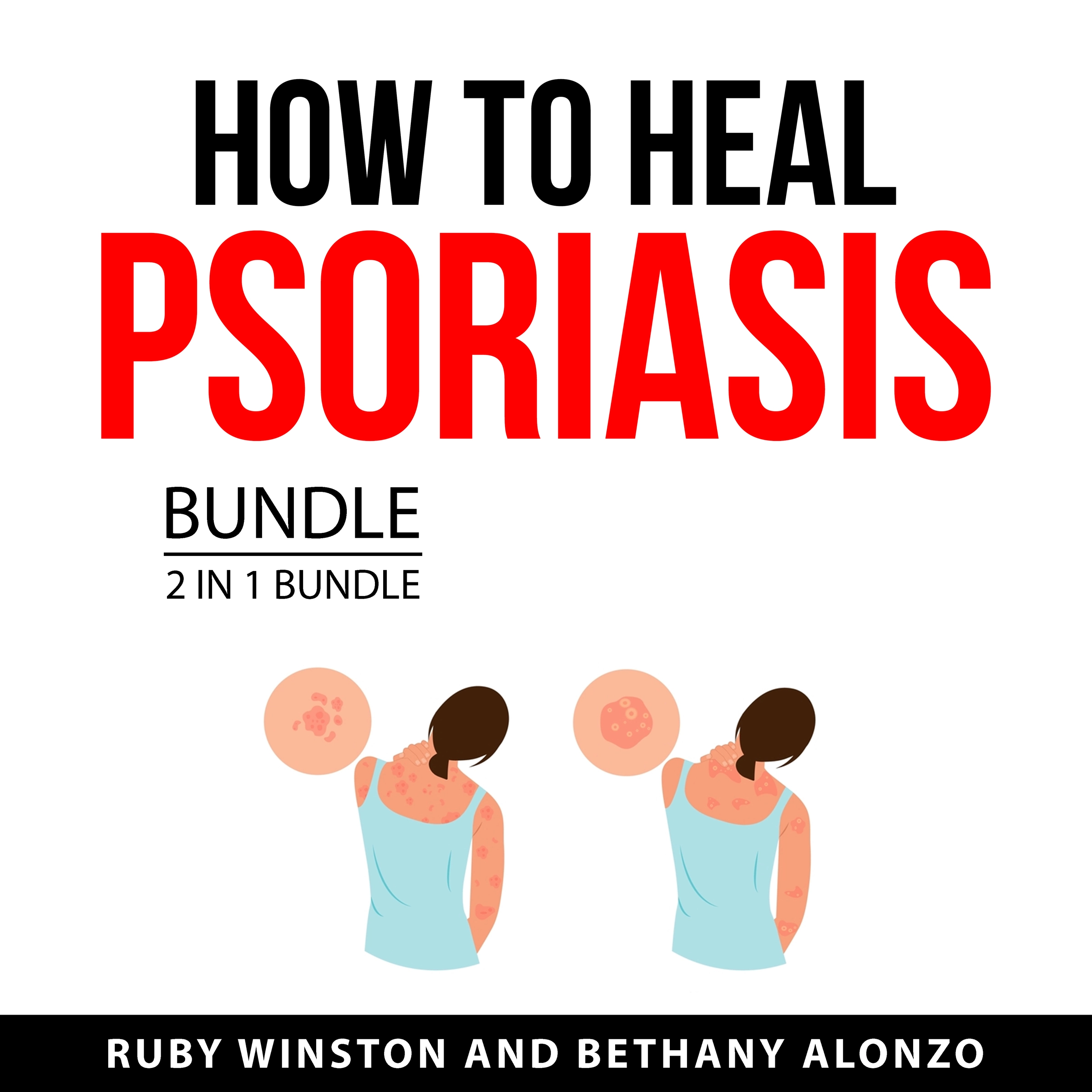 How to Heal Psoriasis Bundle, 2 in 1 Bundle by Bethany Alonzo Audiobook