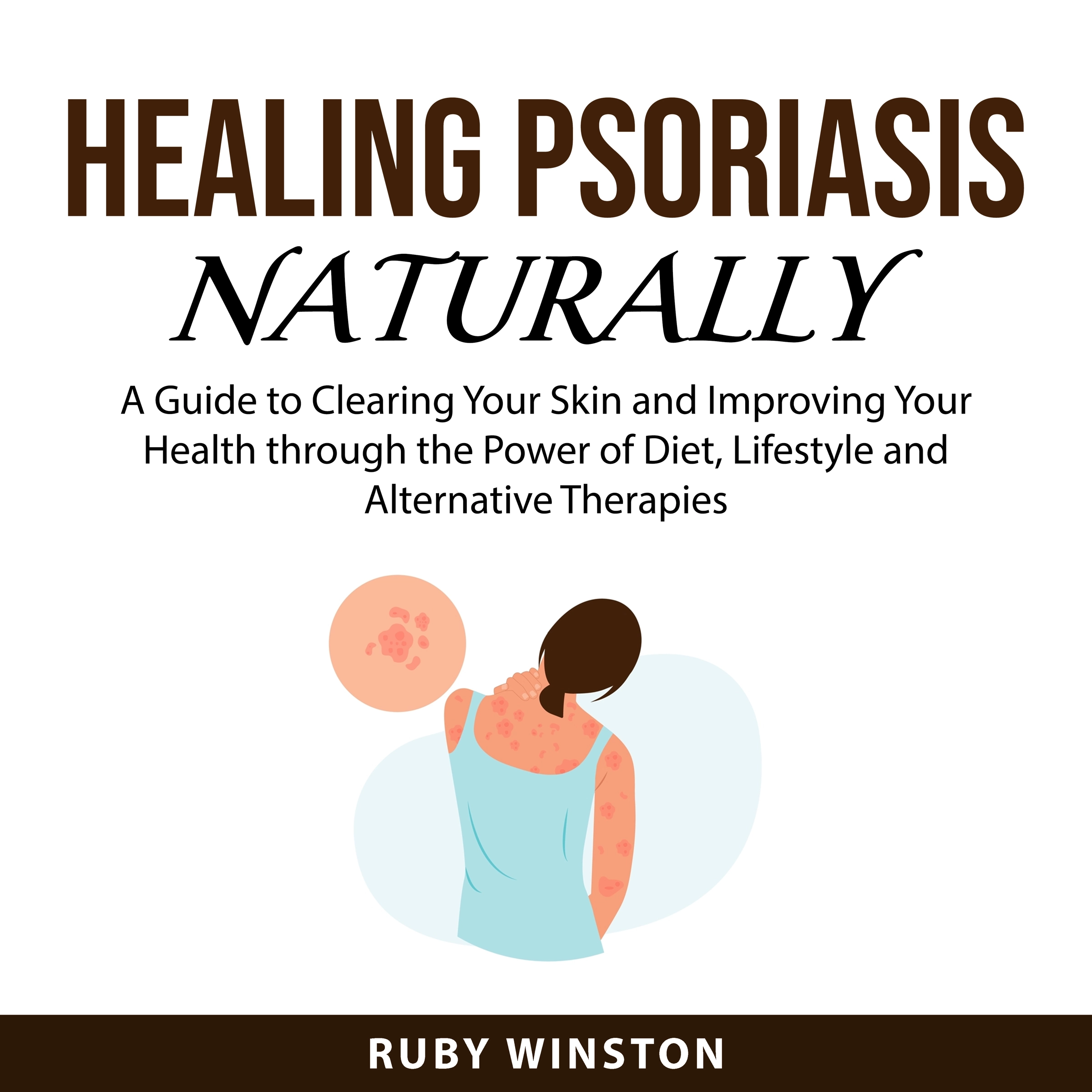 Healing Psoriasis Naturally Audiobook by Ruby Winston